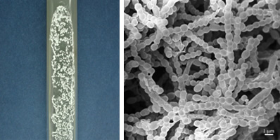 Fig. 5 Prionase-producing microorganism strain 99-GP-2D-5